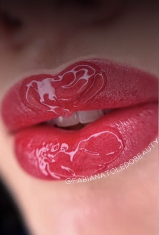 Resultado Micropigmentação Labial