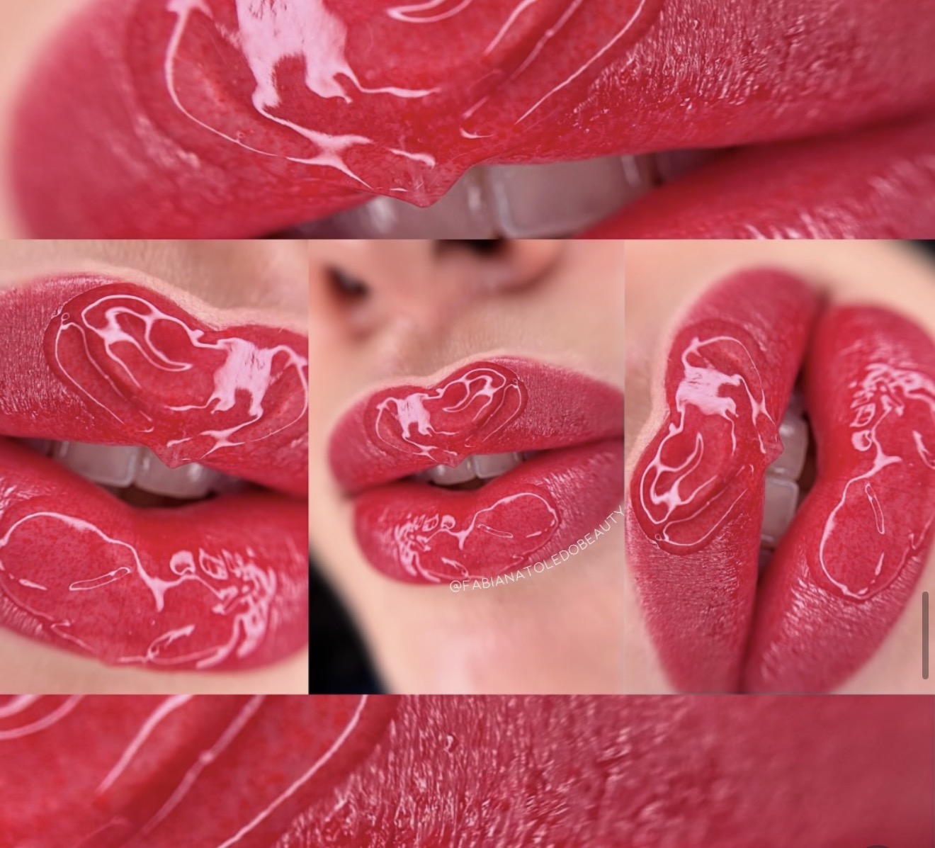 Magnific Lips